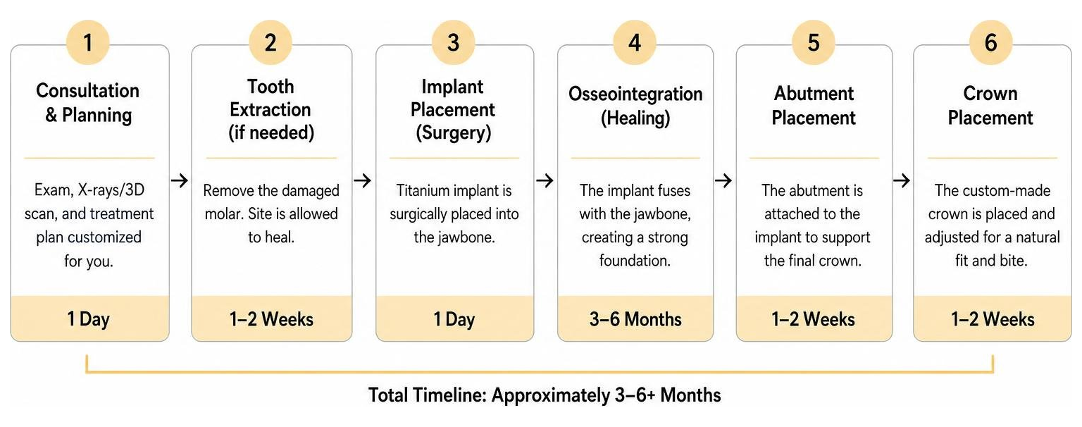 step by step timeline of the molar implant process
