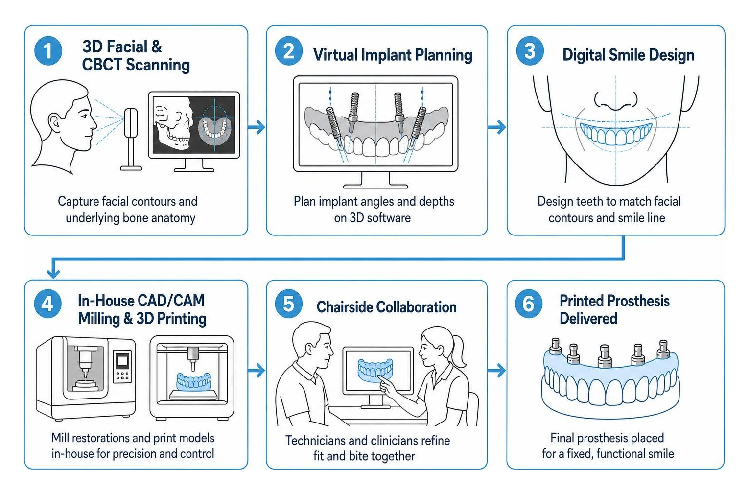 In-house CAD/CAM digital workflow from 3D facial scanning to printed prosthesis