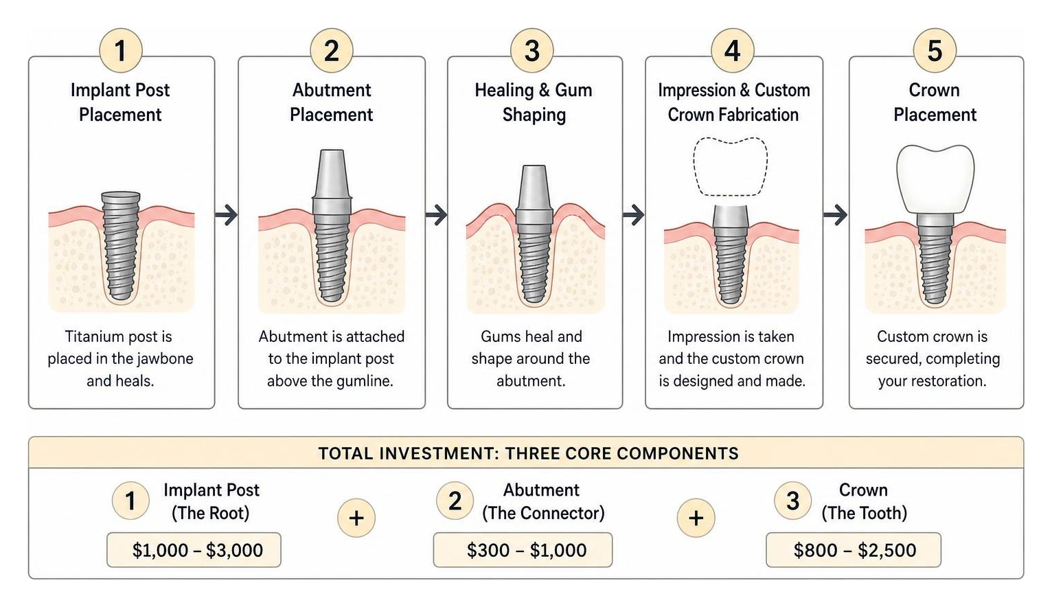 step-by-step implant restoration timeline from post to crown step-by-step implant restoration timeline from post to crown