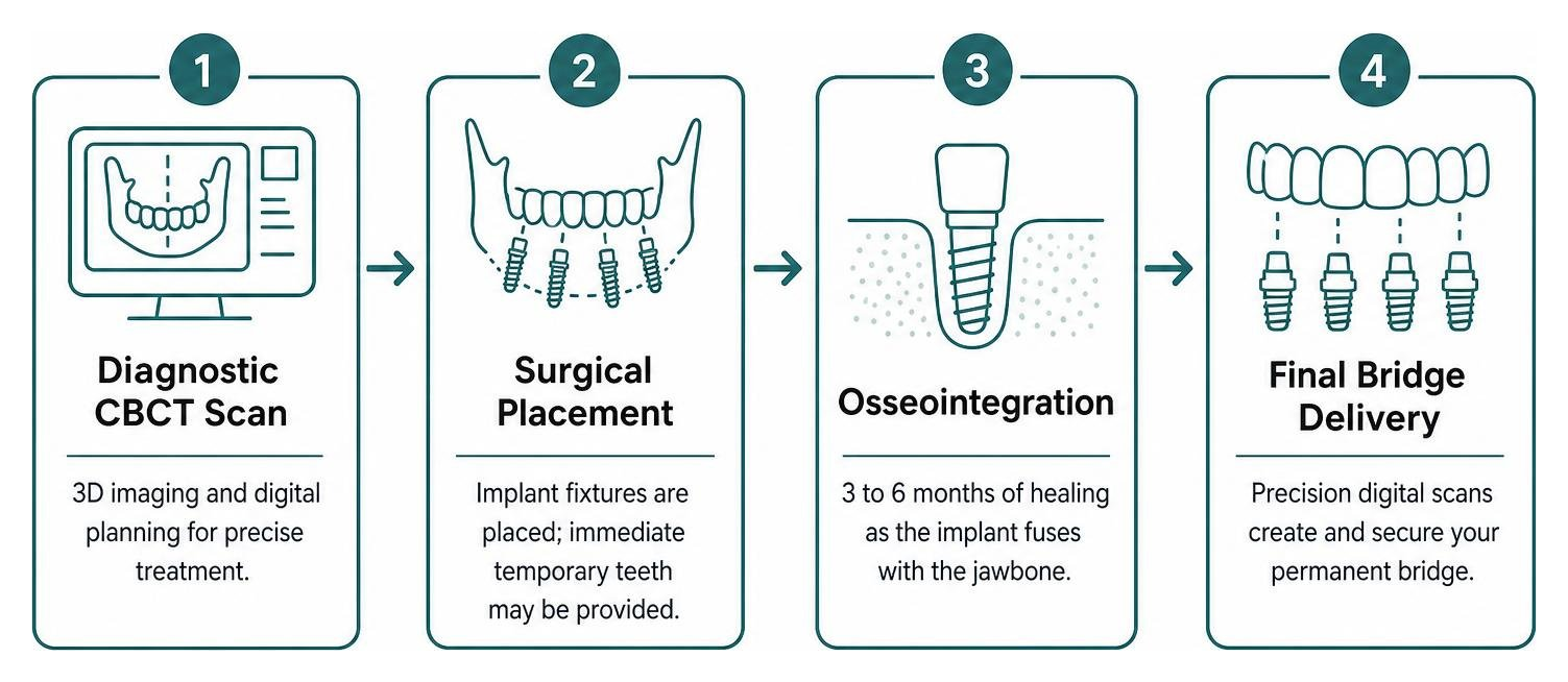Step-by-step clinical process: diagnostic CBCT scan, surgical placement, osseointegration, final bridge delivery