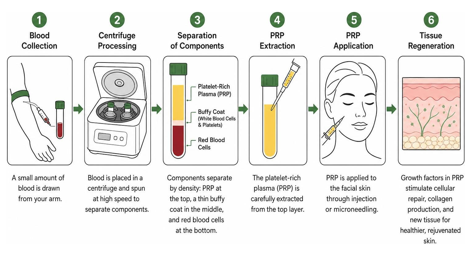 Step-by-step process of PRP preparation to tissue regeneration Step-by-step process of PRP preparation to tissue regeneration