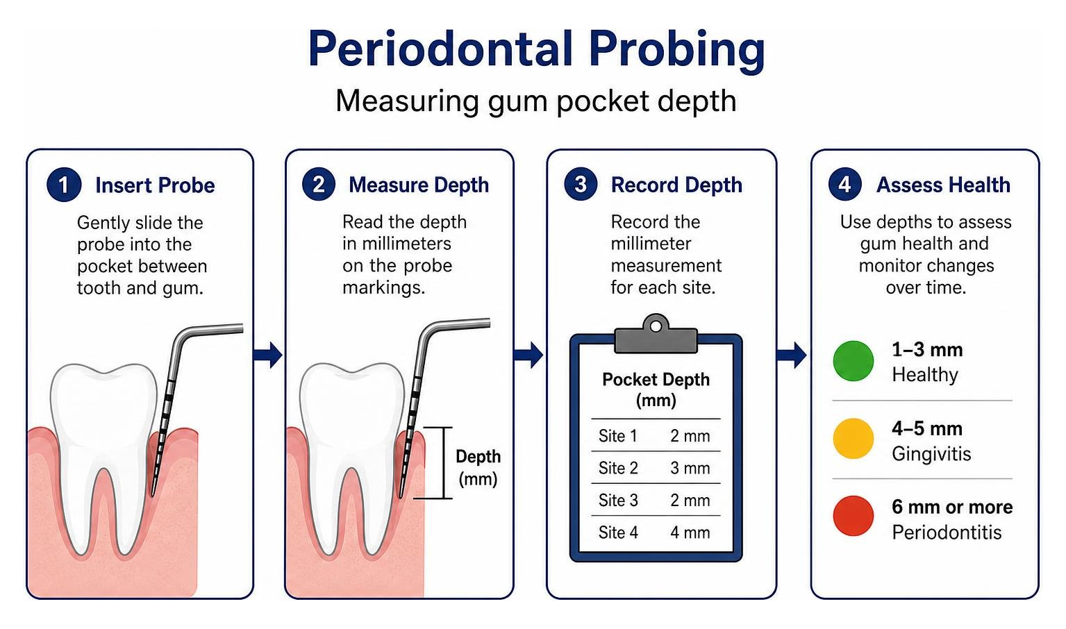 periodontal probe measuring gum pocket depth diagram periodontal probe measuring gum pocket depth diagram