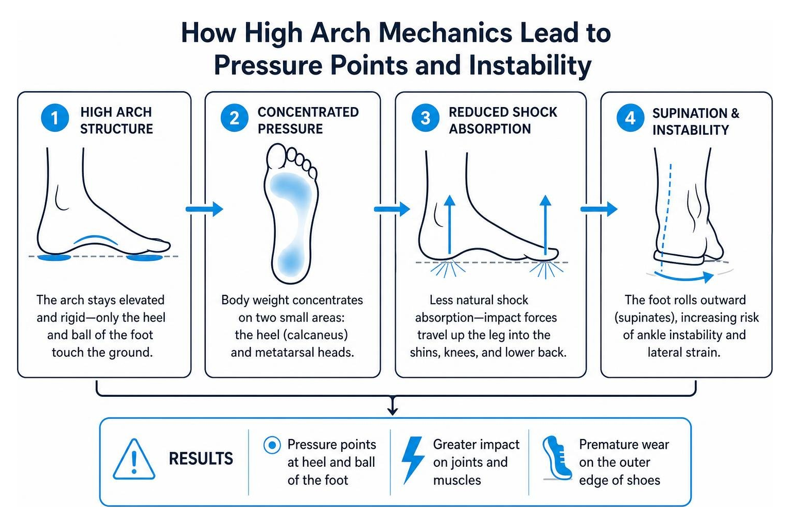 How high arch mechanics lead to pressure points and instability