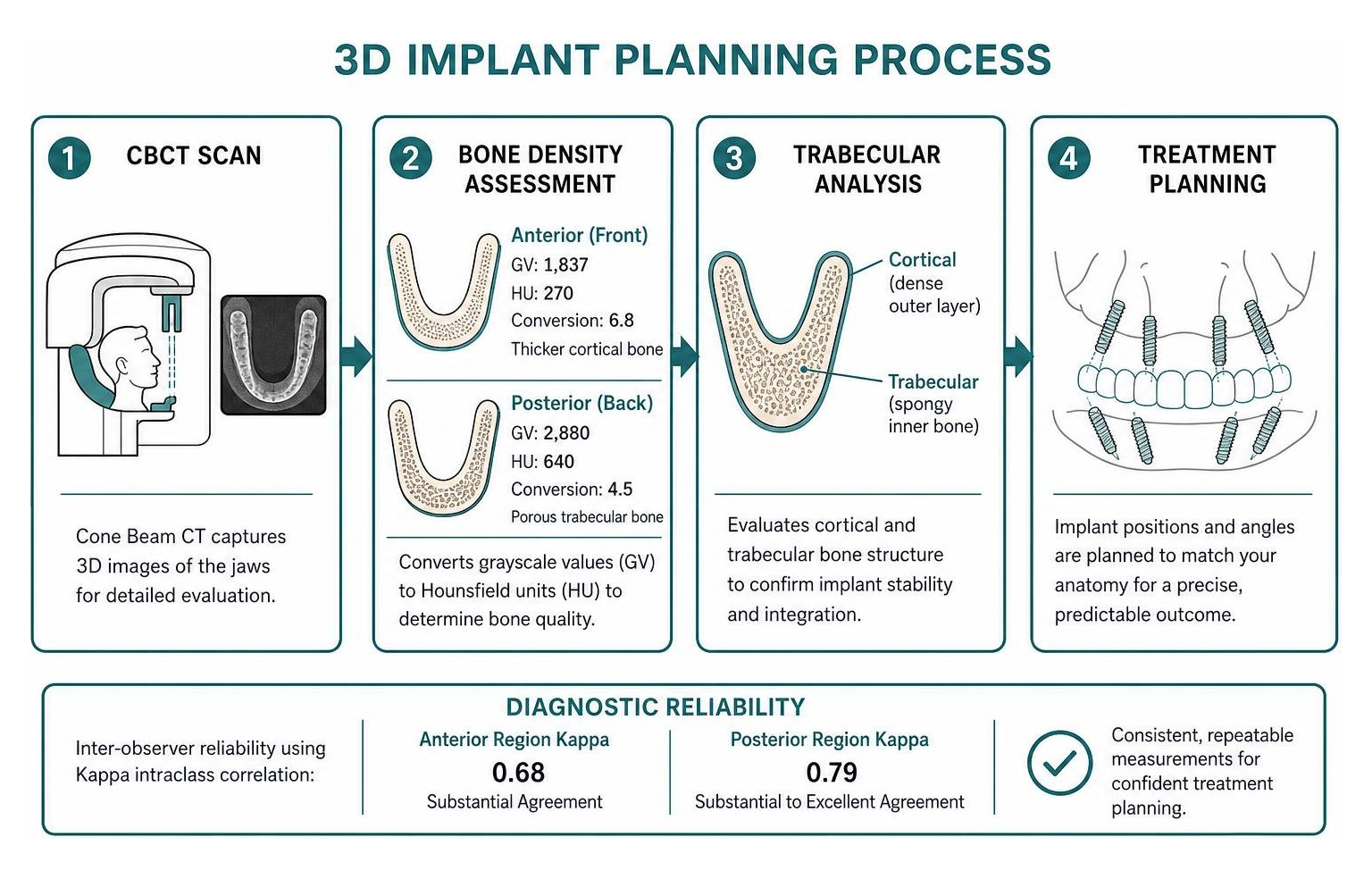 3D implant planning diagram