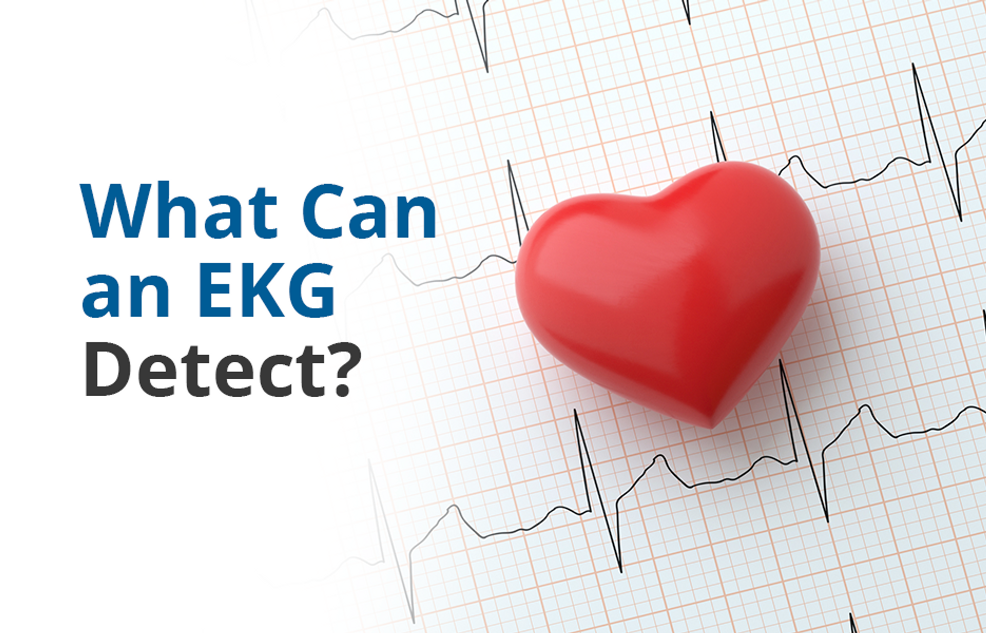 ekg