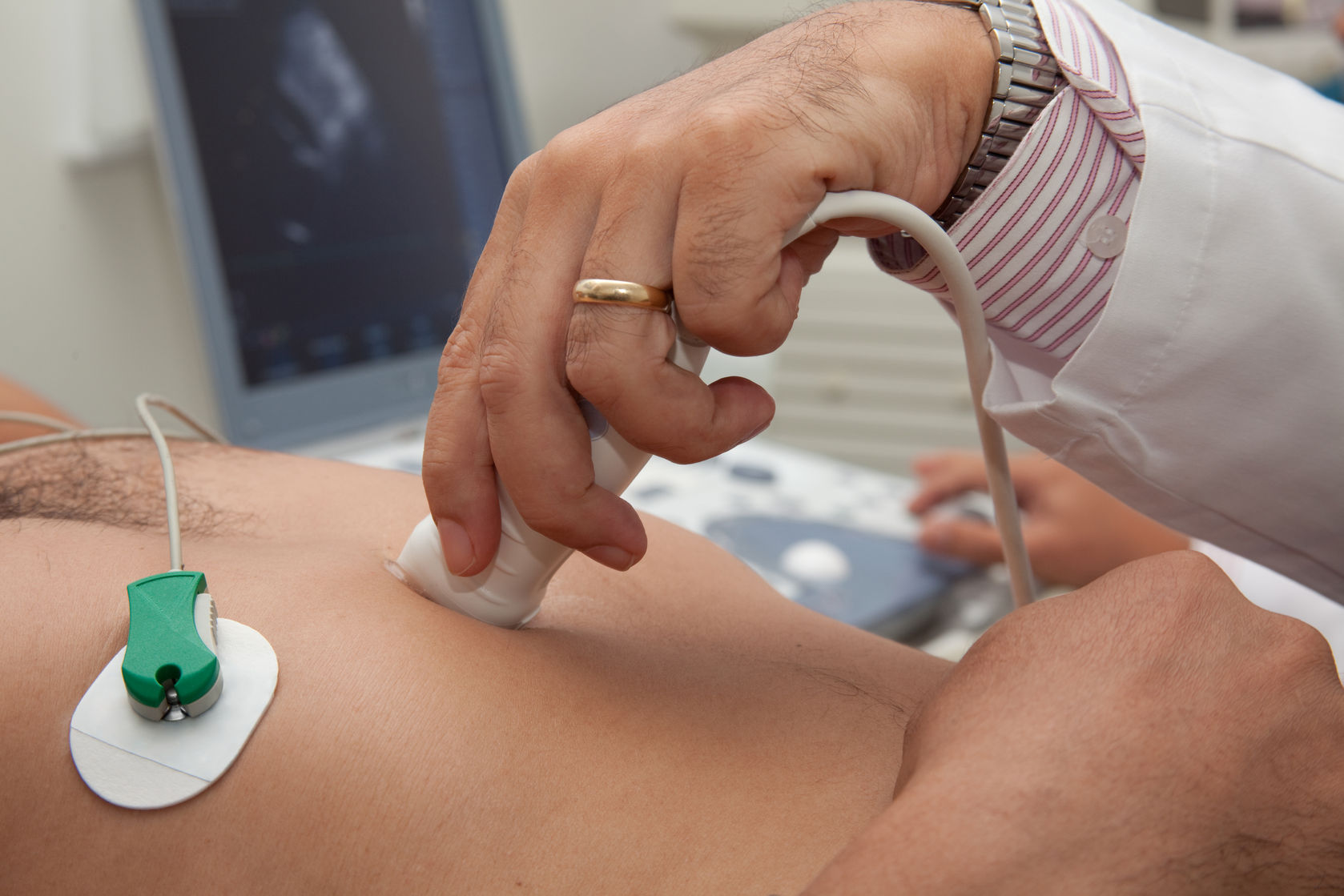 6 Differences Between a Cardiac Sonographer and a Stenographer