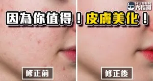 《AE教學》因為你值得！人人都能擁有冰肌玉膚！美膚／磨皮自己來！