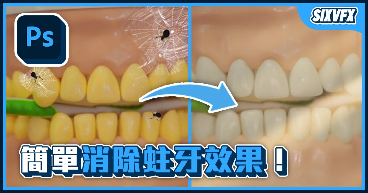 《PS教學》讓蛀牙消失效果!潔白牙齒效果!