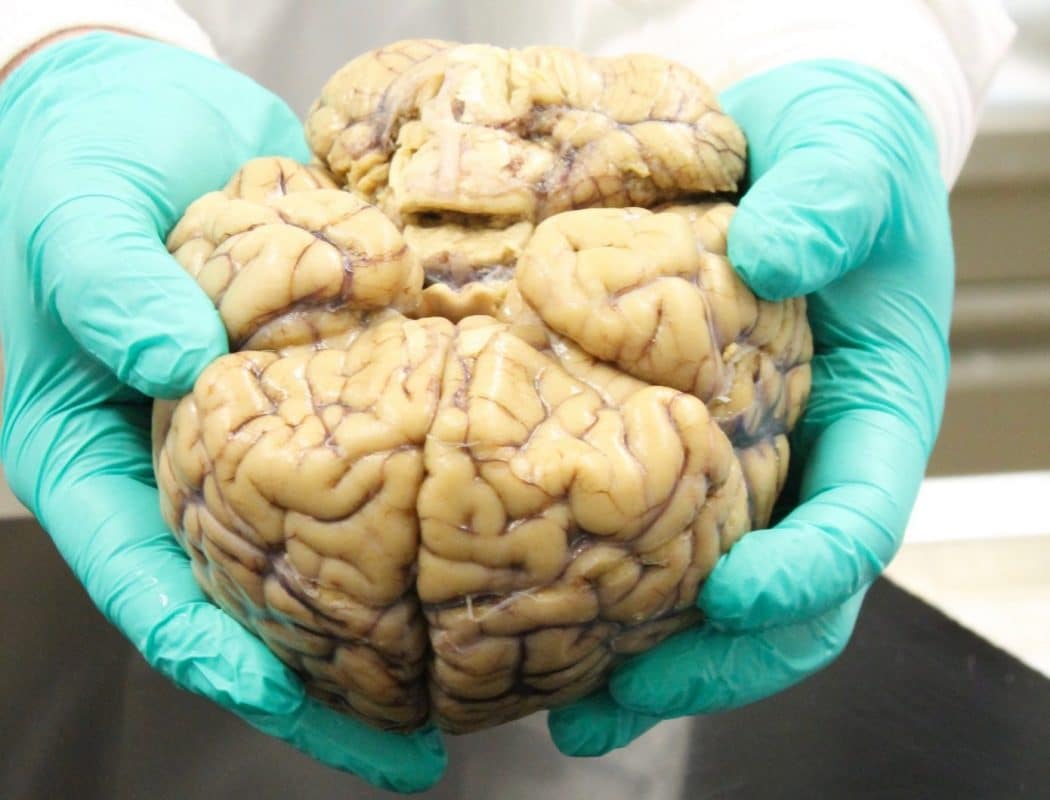 Cient&iacute;fico sostiene cerebro humano con guantes verdes en laboratorio