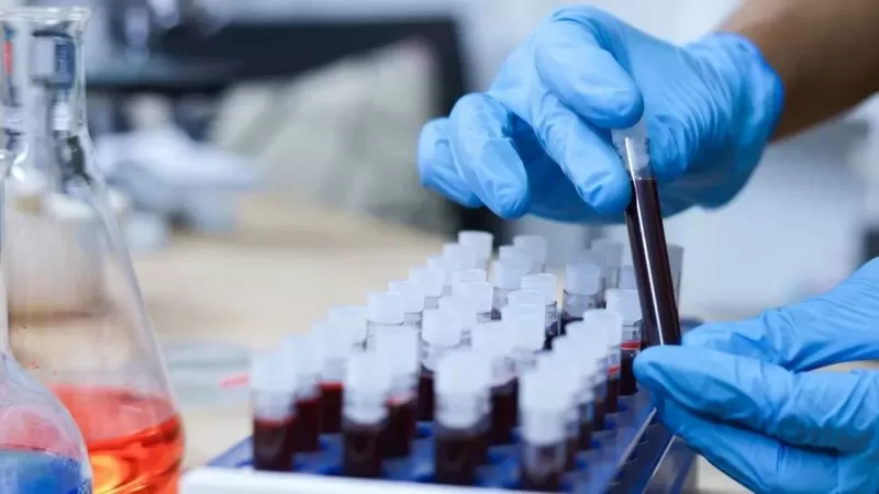 الدراسة دليل على الإمكانيات الهائلة التي تمنحها التقنيات الجديدة في علاج السرطان