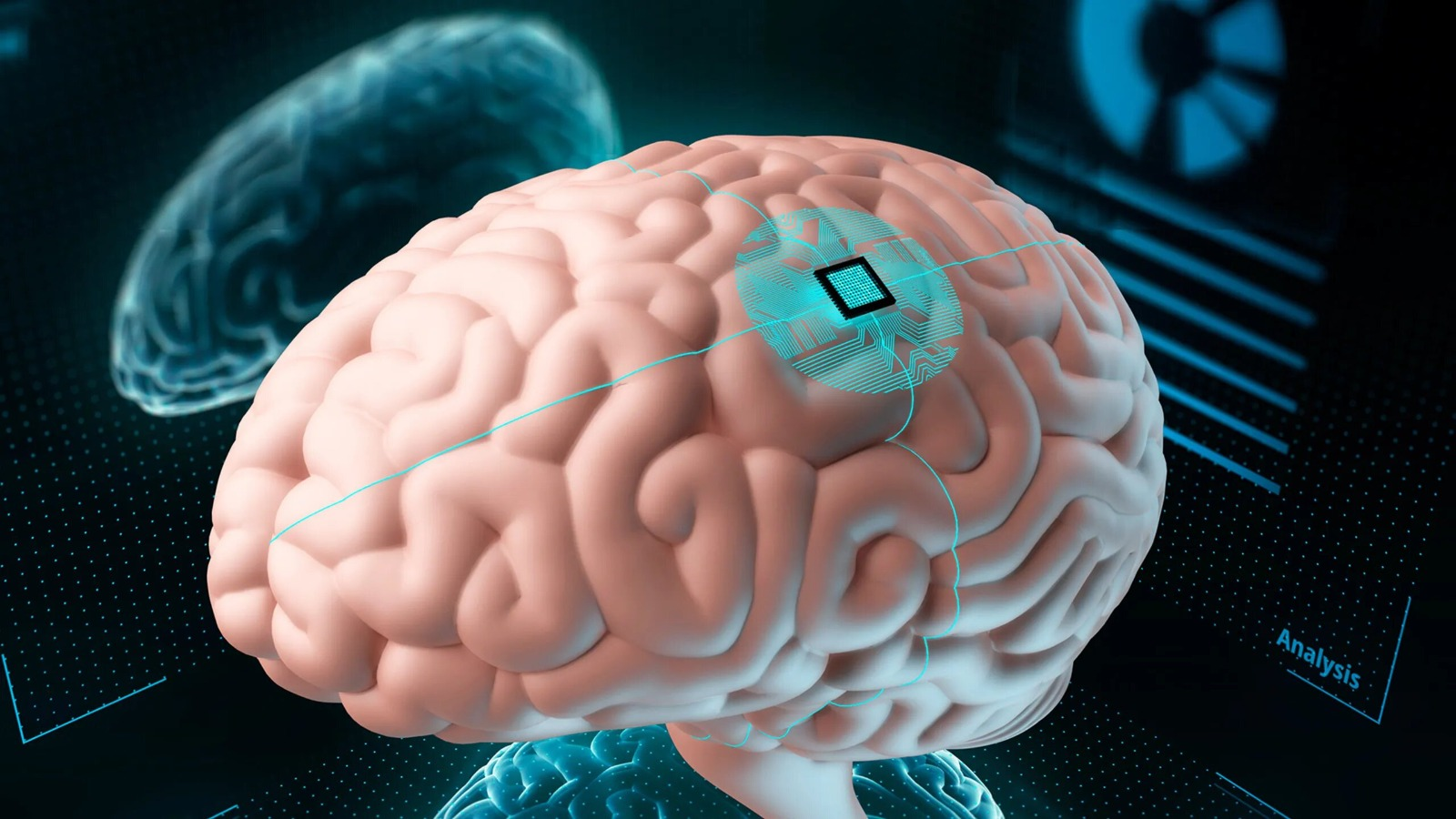 Neuralink y el desarrollo tecnológico bajo el capitalismo: la receta para  la distopía - Política Obrera