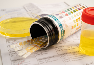 Advanced Urinalysis