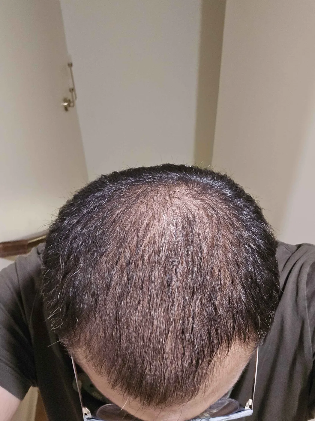 darkprinx2500's crown in July