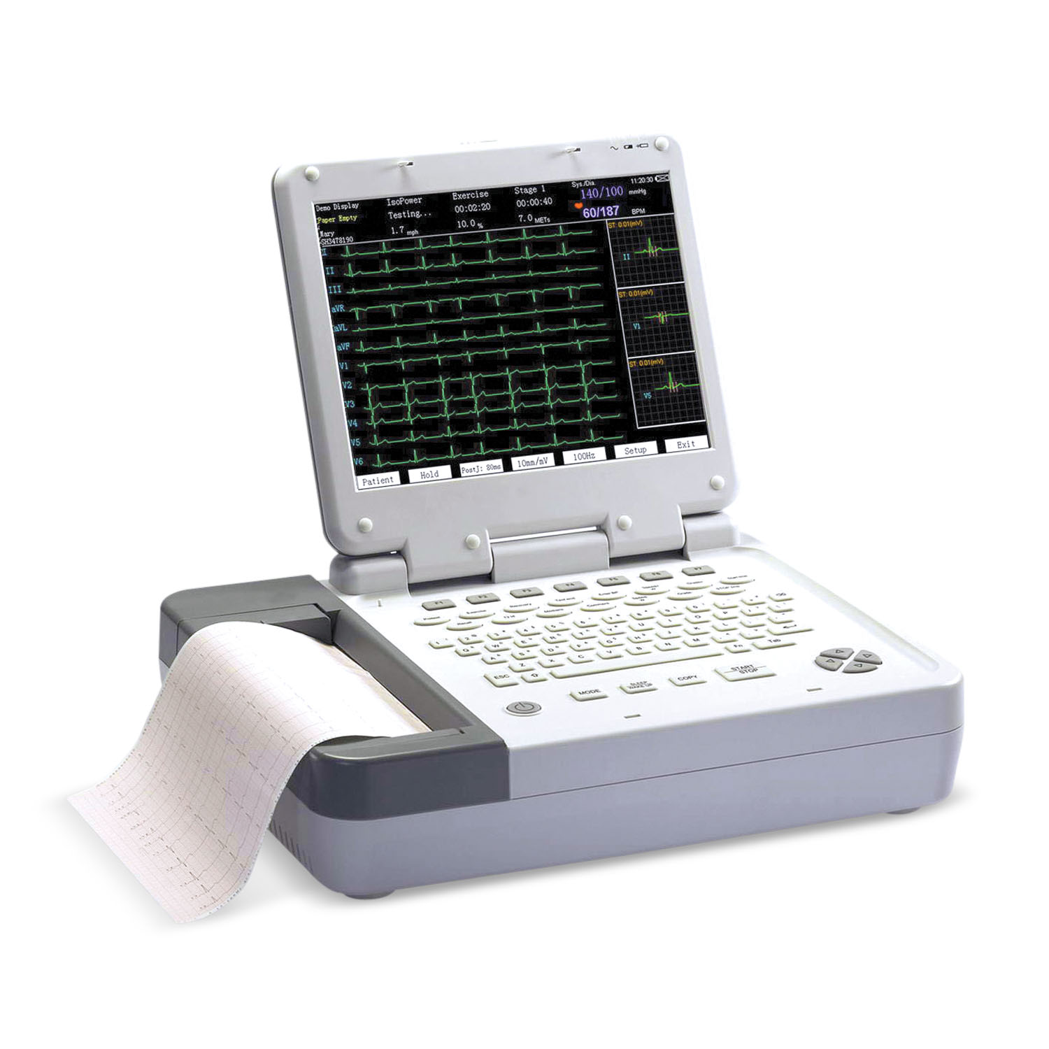 Universal ECG & Portable PC-Based 12-Lead ECG