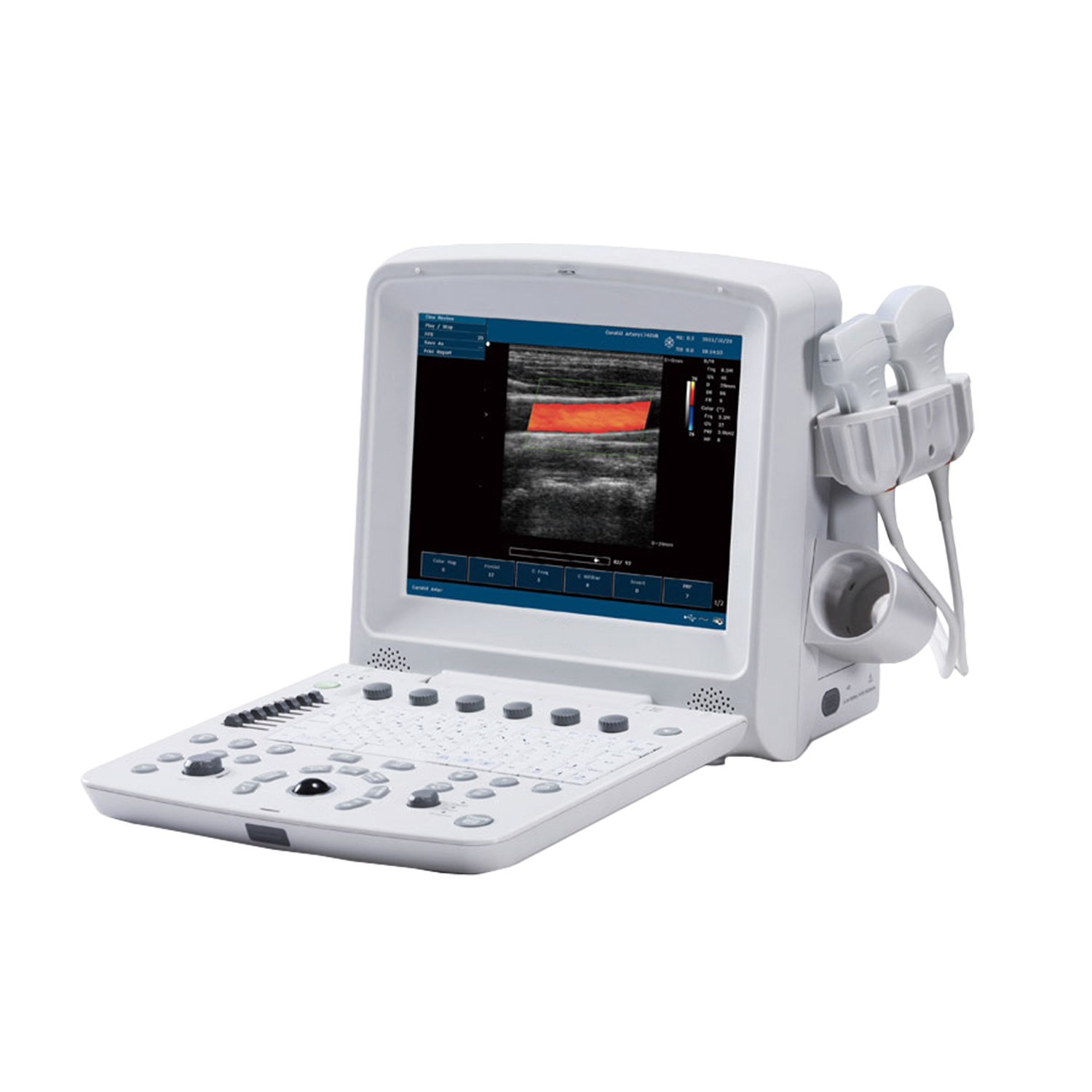 Avante Crystal 4P Color Doppler Ultrasound System