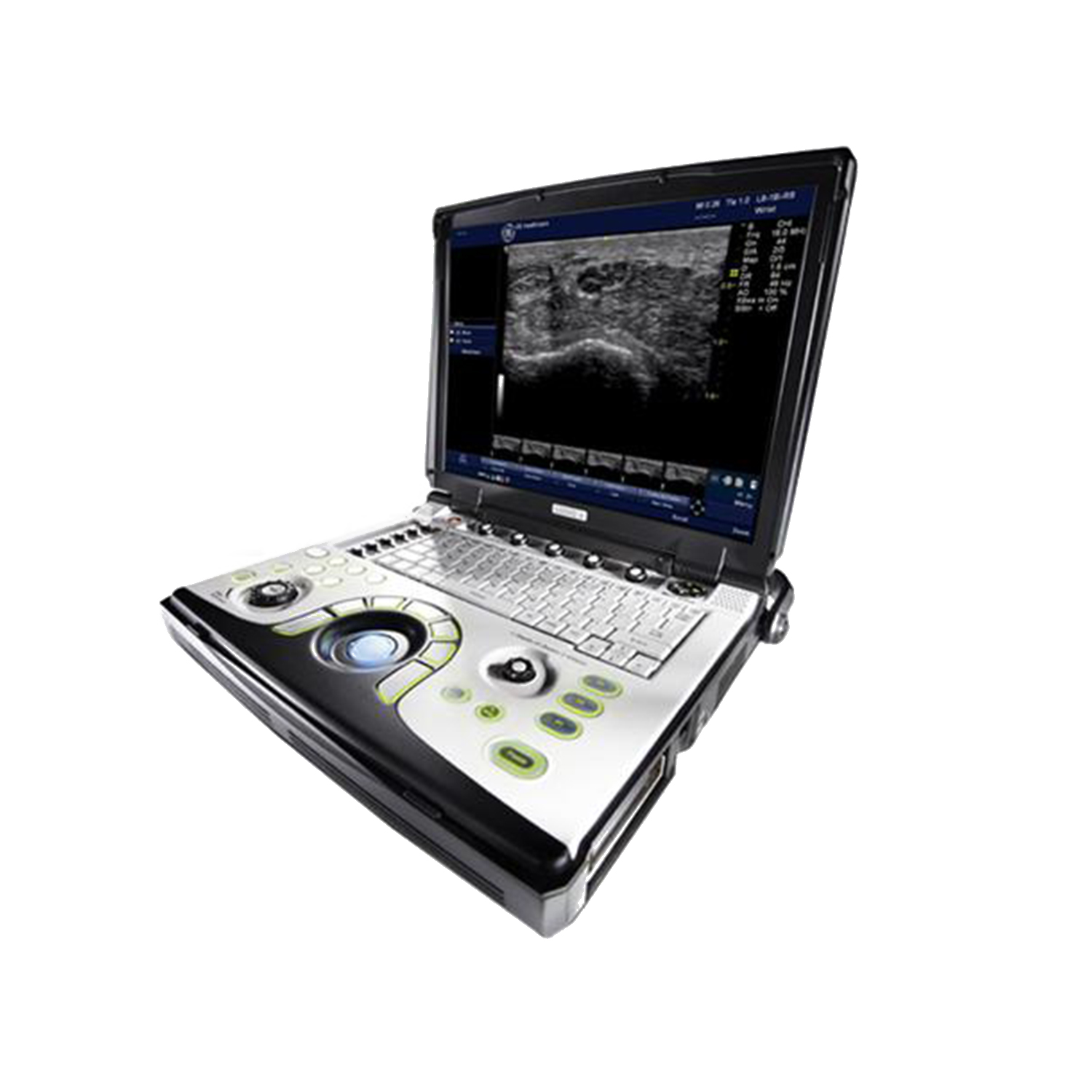 GE LOGIQ e BT12 Portable Ultrasound