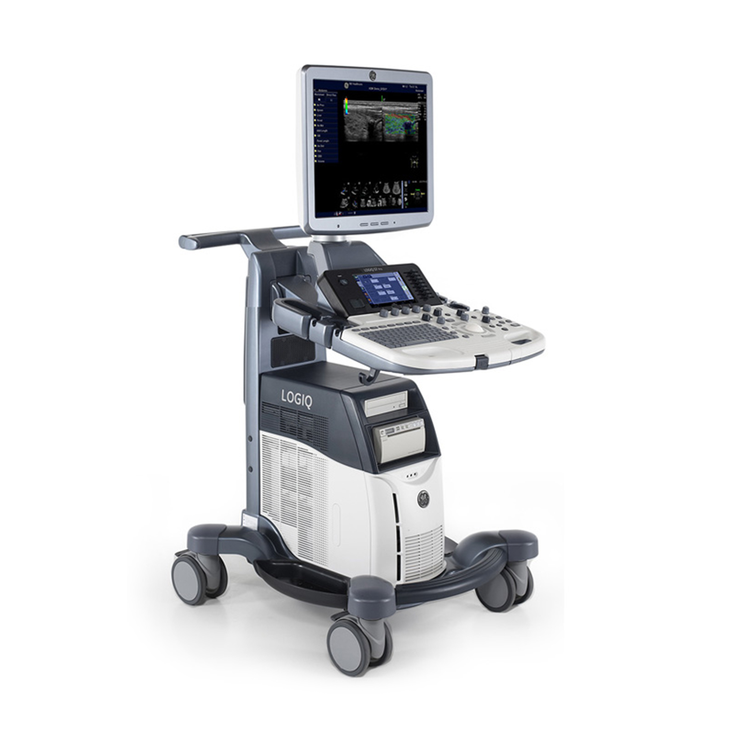 GE Logiq S7 Ultrasound System