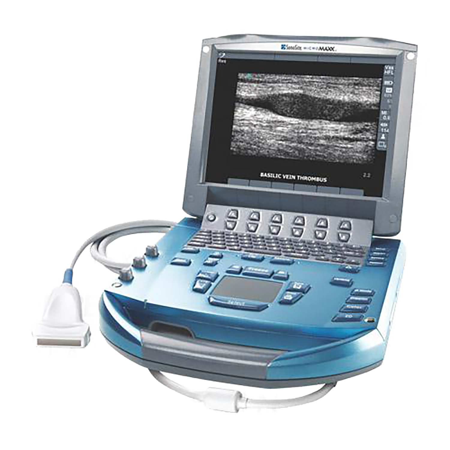 Sonosite Micromaxx Ultrasound System