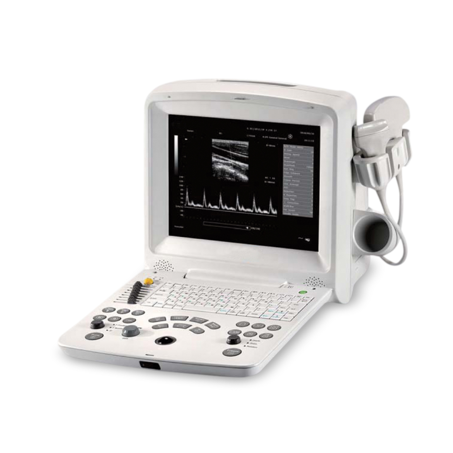 Avante FS-60 Advance Digital Ultrasound System