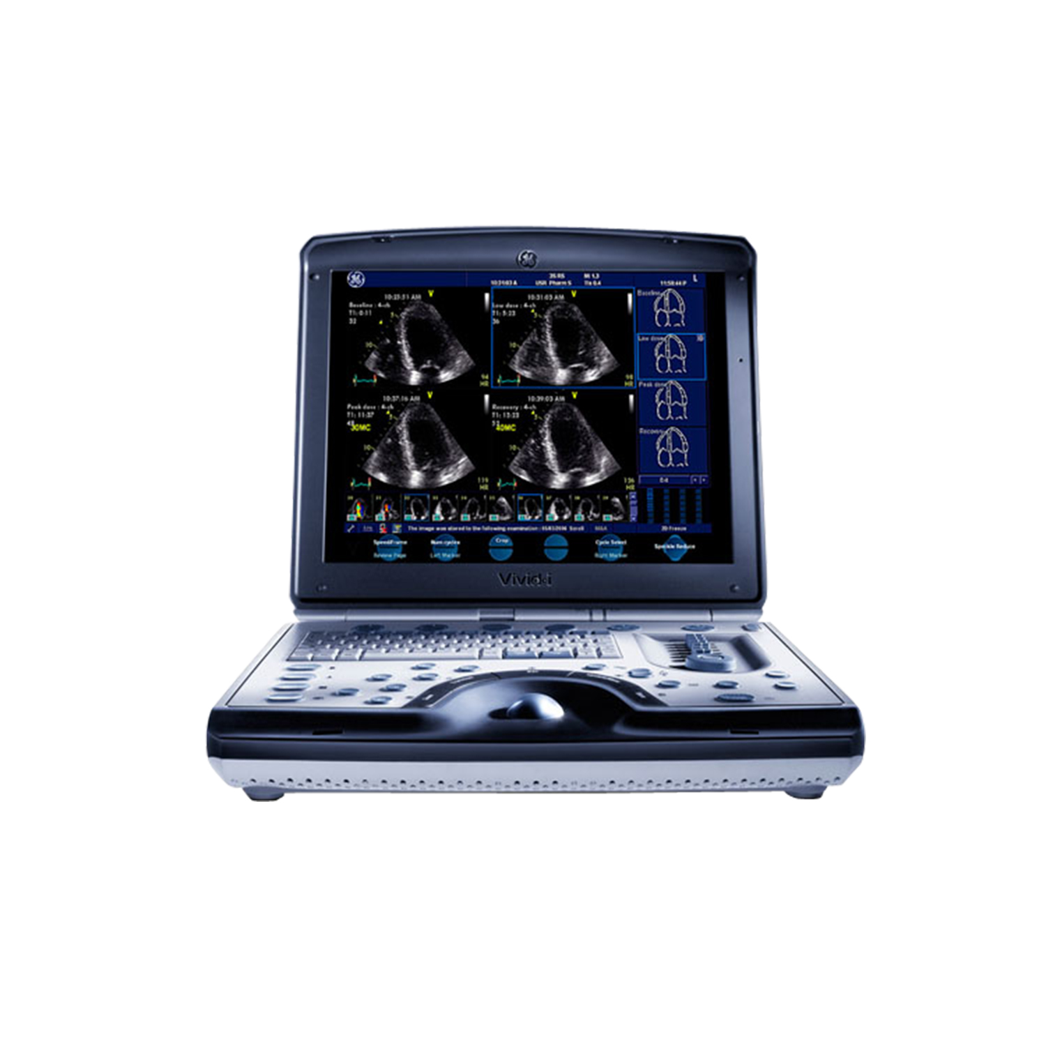 GE Vivid i Portable Cardiac Ultrasound System
