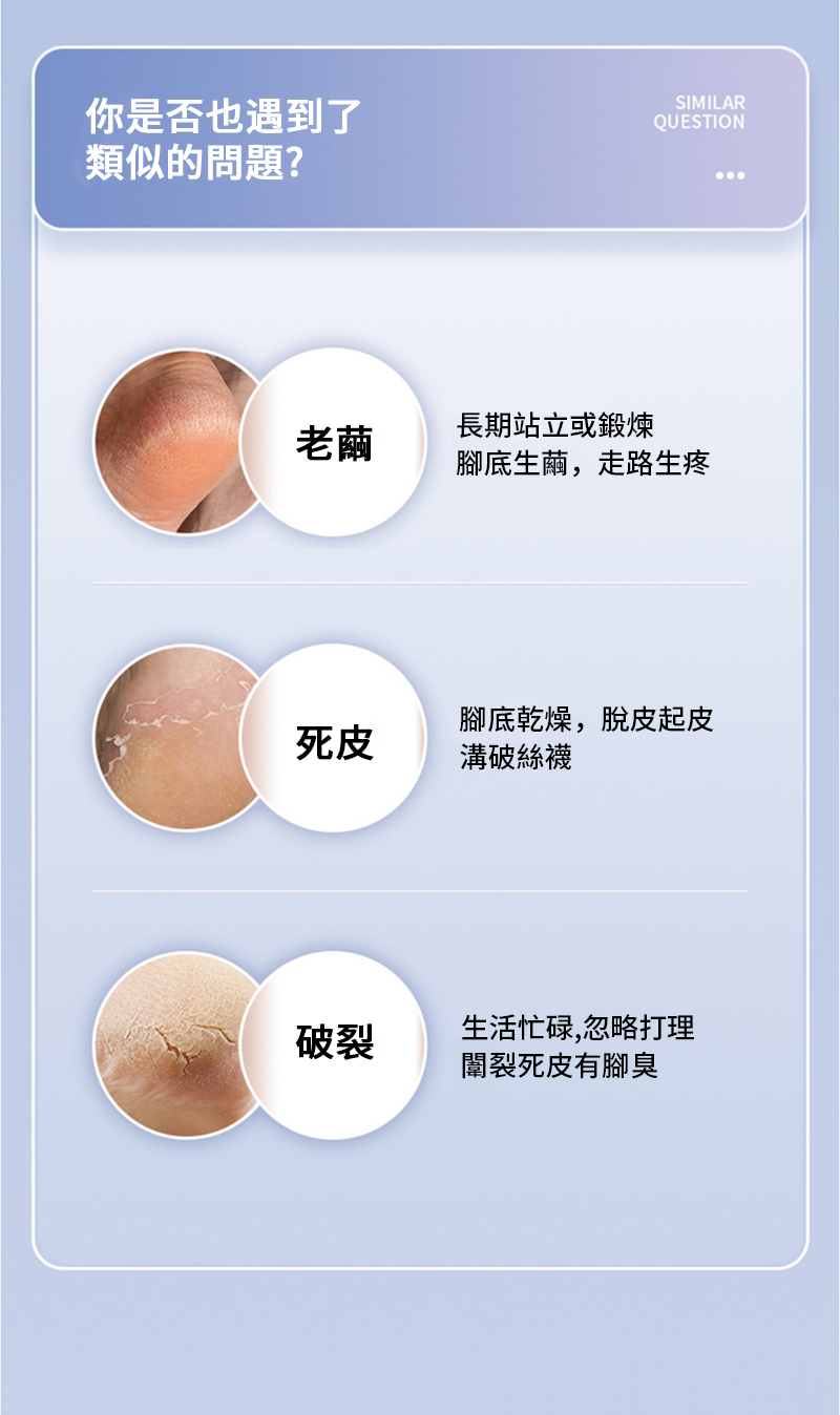 你是否也遇到了類似的問題?SIMILARQUESTION老繭長期站立或鍛煉腳底生繭,走路生疼腳底乾燥,脫皮起皮死皮溝破絲襪破裂生活忙碌,忽略打理闈裂死皮有腳臭