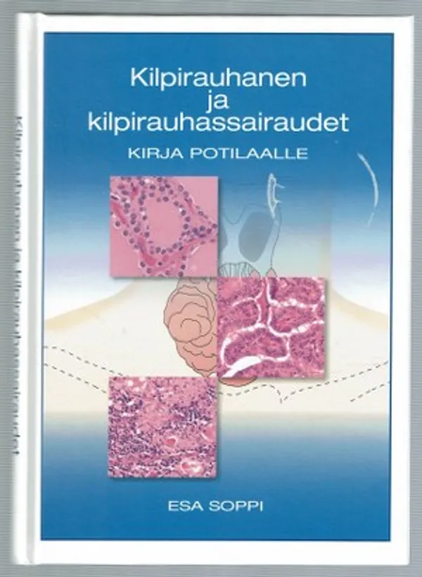 Kilpirauhanen ja kilpirauhassairaudet. Kirja potilaalle - Soppi, Esa | Päijänne Antikvariaatti Oy | Osta Antikvaarista - Kirjakauppa verkossa