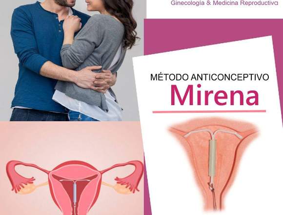 Clínica Gynemer  MÉTODO ANTICONCEPTIVO MIRENA 