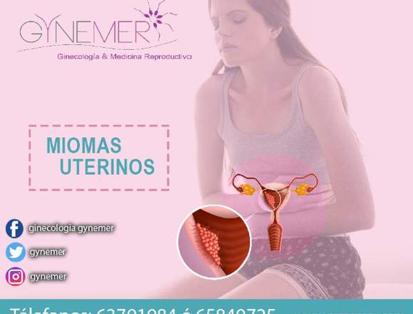 Clínica Gynemer MIOMAS UTERINOS