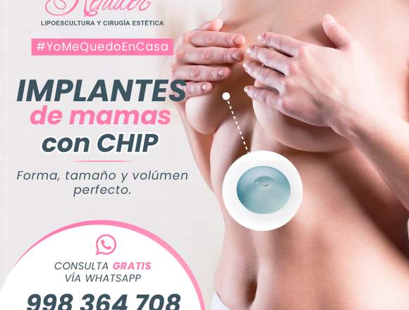 Nuevos implantes mamarios