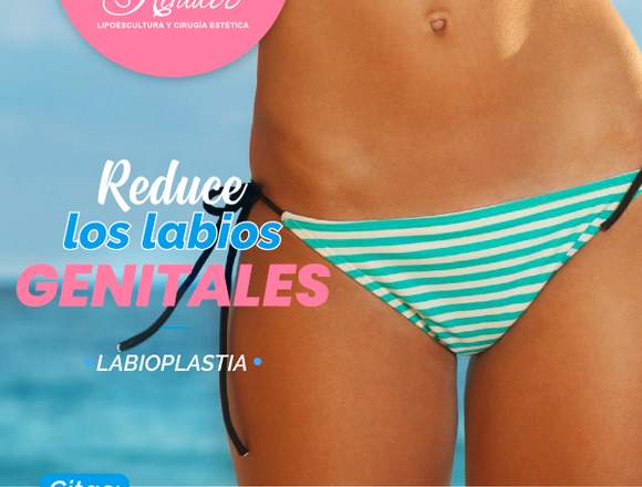 Labioplastia vaginal - Clínica Renacer