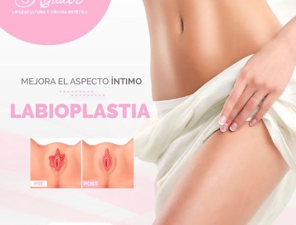 Labioplastia Vaginal - Clínica Renacer