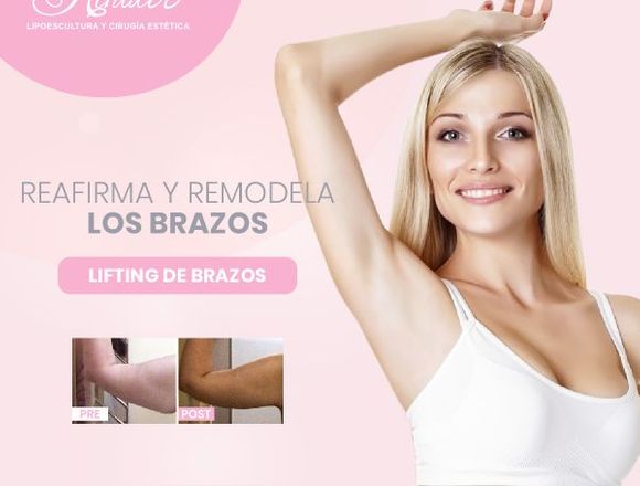 Consigue unos brazos delgados - Clínica Renacer