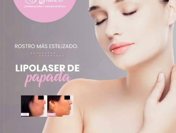 Reduce tu papada con lipolaser - Clínica Renacer