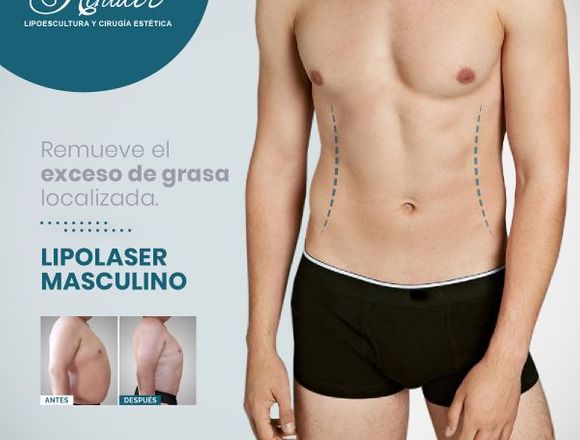 Moldea la figura del hombre - Clínica Renacer