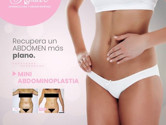 Corrige la flacidez abdominal - Clínica Renacer