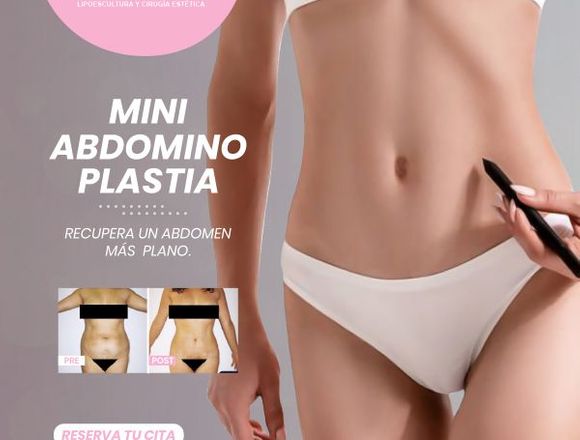 Mini reconstrucción abdominal - Clínica Renacer