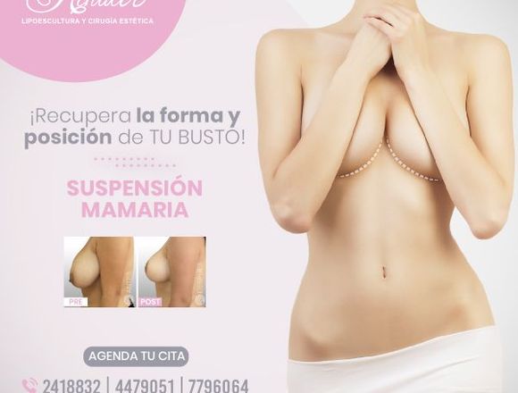 Vuelve a elevar el busto caído - Clínica Renacer