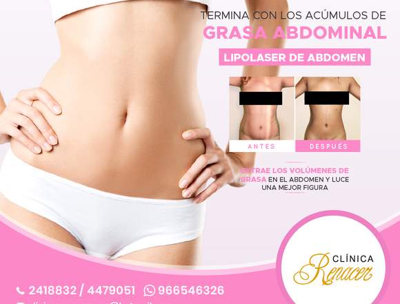 Lipolaser Abdominal - Clínica Renacer