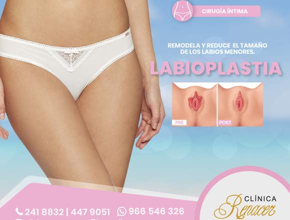 Cirugía Labioplastia reductiva - Clínica Renacer