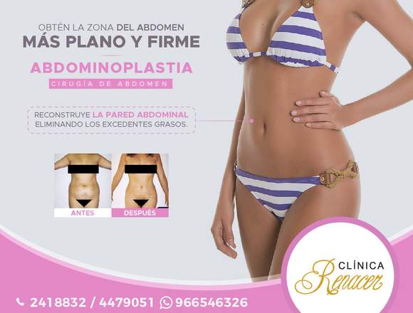 Restaura el aspecto abdominal - Clínica Renacer