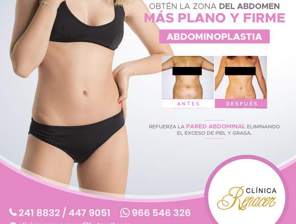 Corrige la flacidez abdominal - Clínica Renacer