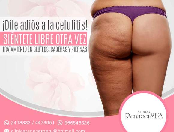 Combate la celulitis-clínica renacer spa