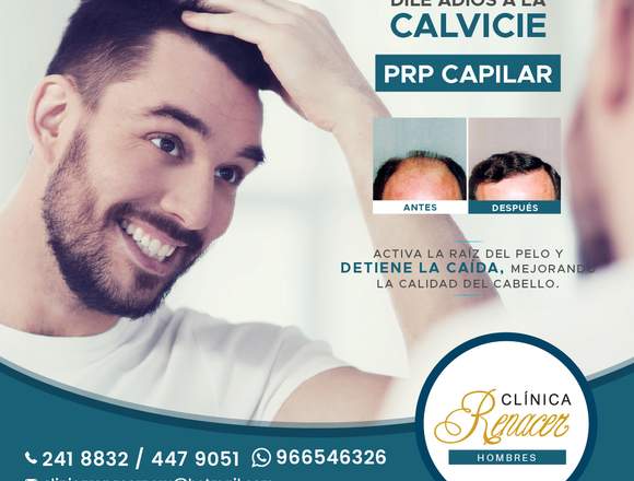 PRP contra la Alopecia - Clínica Renacer