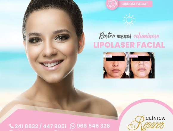 Elimina la grasa facial - Clínica Renacer