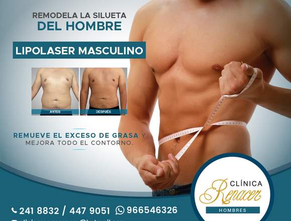 Lipolaser para hombres - Clínica Renacer