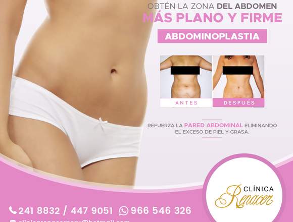 Cirugía de la pared abdominal - Clínica Renacer