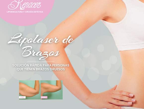 Brazos delgados con lipolaser - Clínica Renacer