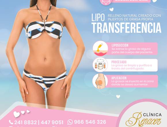 Relleno corporal Lipotransferencia.