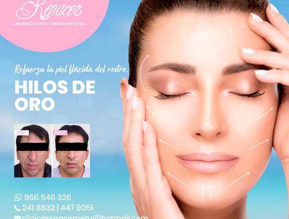 Reafirma tu rostro con hilos - Clínica Renacer