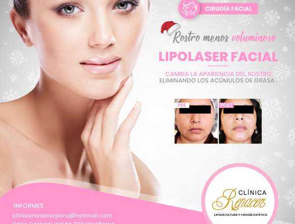 Cirugía Lipolaser Facial - Clínica Renacer